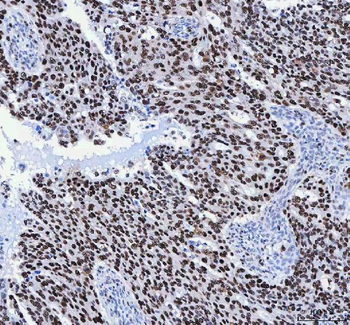FEN1 Rabbit Polyclonal Antibody