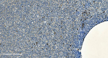 CD20/MS4A1 Rabbit Polyclonal Antibody