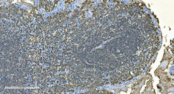 CD20/MS4A1 Rabbit Polyclonal Antibody