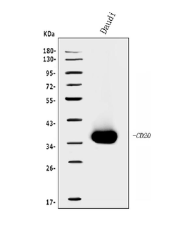 CD20/MS4A1 Rabbit Polyclonal Antibody