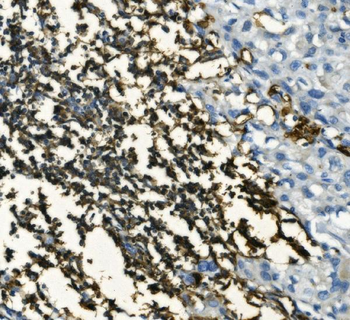 CD20/MS4A1 Rabbit Polyclonal Antibody