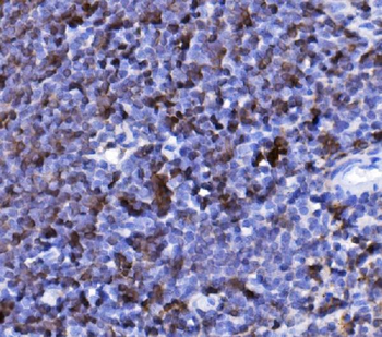 CD20/MS4A1 Rabbit Polyclonal Antibody