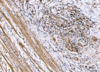 ACADM/MCAD Rabbit Polyclonal Antibody