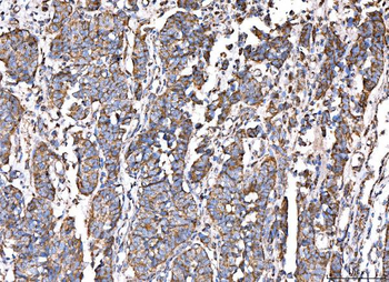 ACADM/MCAD Rabbit Polyclonal Antibody