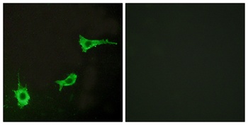 ETAR rabbit pAb Antibody