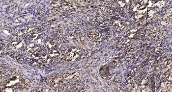 MLTK rabbit pAb Antibody
