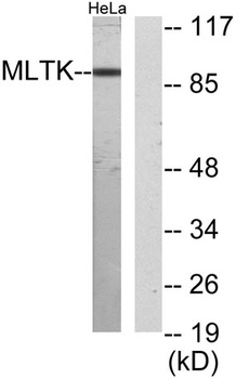 MLTK rabbit pAb Antibody