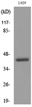 CD116 rabbit pAb Antibody