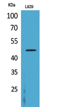 CD116 rabbit pAb Antibody