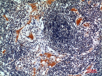 CD116 rabbit pAb Antibody