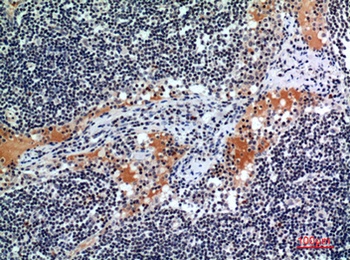 CD116 rabbit pAb Antibody