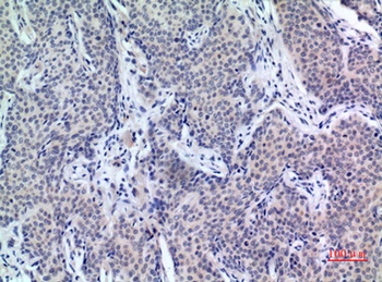 PDGF-D rabbit pAb Antibody