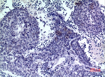 PDGF-D rabbit pAb Antibody