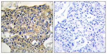 EGFR (phospho Tyr1016) rabbit pAb Antibody