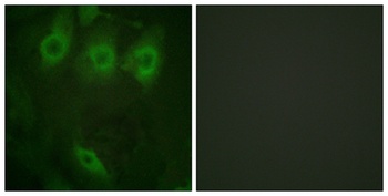 EGFR (phospho Tyr1016) rabbit pAb Antibody
