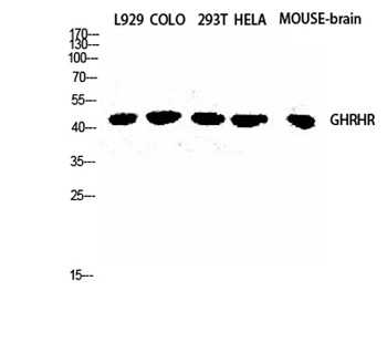 GHRH-R rabbit pAb Antibody