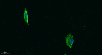 PCB rabbit pAb Antibody