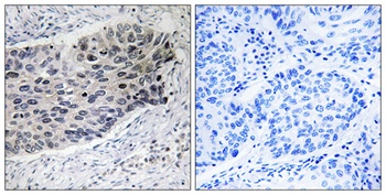 PCB rabbit pAb Antibody