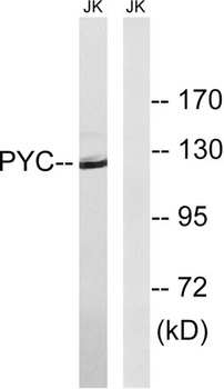 PCB rabbit pAb Antibody