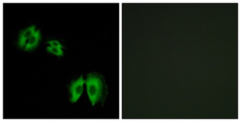 β-1,3-Gal-T2 rabbit pAb Antibody