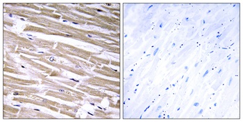 β-1,3-Gal-T2 rabbit pAb Antibody
