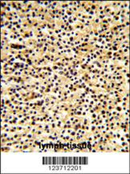 DTX1 Antibody (Center)