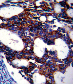 TGFB2 Antibody