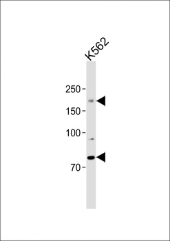 ALK antibody