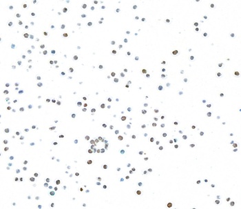 Ki-67 Rabbit Recombinant Monoclonal Antibody