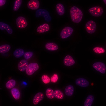 Ki-67 Rabbit Recombinant Monoclonal Antibody