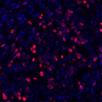 Ki-67 Rabbit Recombinant Monoclonal Antibody