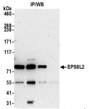 Rabbit EPS8L2 Antibody