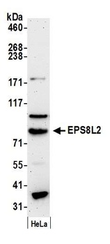 Rabbit EPS8L2 Antibody