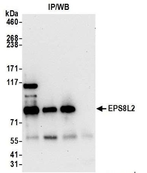 Rabbit EPS8L2 Antibody