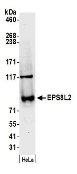Rabbit EPS8L2 Antibody