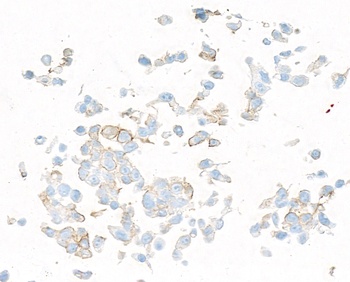 Rabbit PDGFR beta Recombinant Monoclonal Antibody