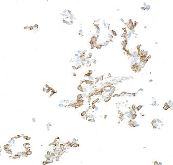 Rabbit PDGFR beta Recombinant Monoclonal Antibody