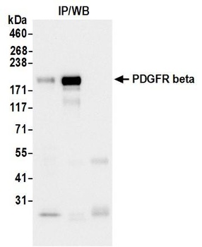 Rabbit PDGFR beta Recombinant Monoclonal Antibody