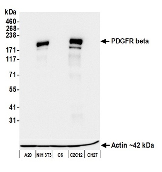 Rabbit PDGFR beta Recombinant Monoclonal Antibody