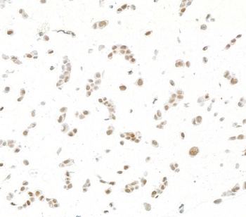 Rabbit JDP2 Recombinant Monoclonal Antibody