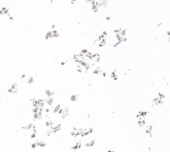 Rabbit JDP2 Recombinant Monoclonal Antibody