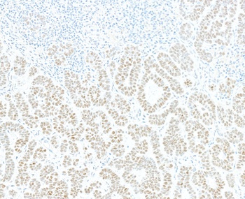 Rabbit JDP2 Recombinant Monoclonal Antibody