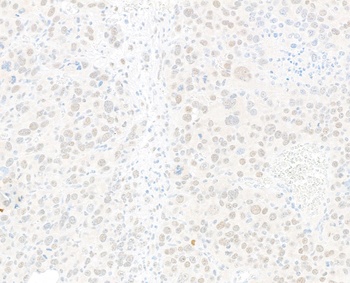 Rabbit JDP2 Recombinant Monoclonal Antibody