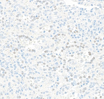 Rabbit JDP2 Recombinant Monoclonal Antibody