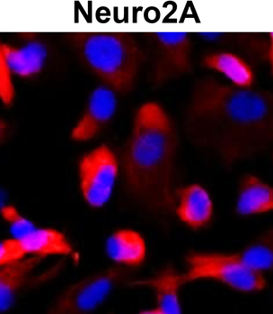 Nestin Rabbit Polyclonal Antibody