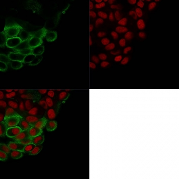 MUC-1 Antibody