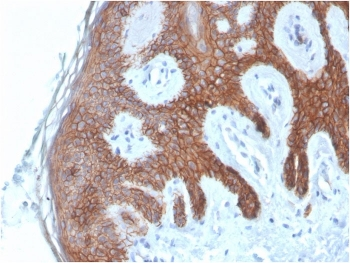 Cadherin 1 Antibody / CDH1 / E-Cadherin