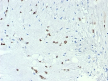 Brachyury Antibody / TBXT / Protein T