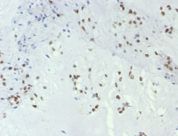 TBXT Antibody / Brachyury / Protein T