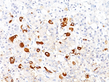 TSHB Antibody / TSH beta
